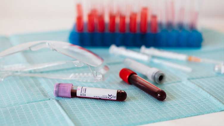 Plastic particles found in human blood for first time