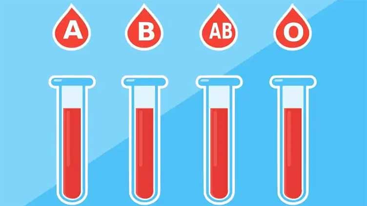 Blood Type May Be Linked to Risk of Stroke Before Age 60