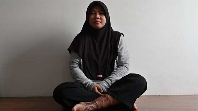 Indonesian maid's torture highlights lack of legal protections