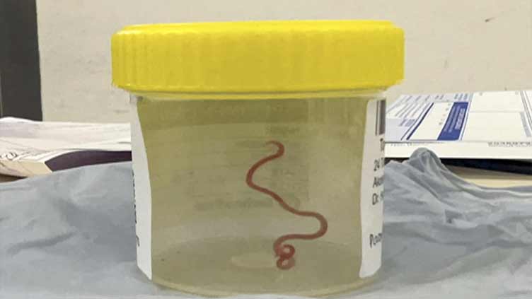 Neurosurgeon removes worm from Australian woman's brain 