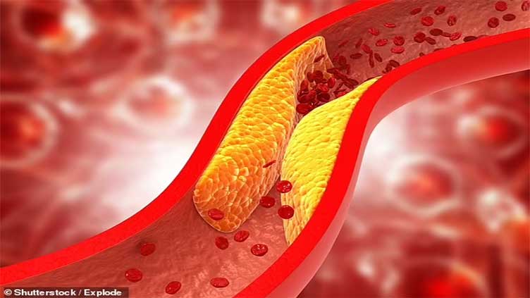 Scientists develop vaccine to lower cholesterol which is linked to 18m deaths a year