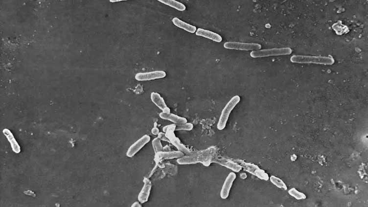 Eye drops linked to US drug-resistant bacteria outbreak