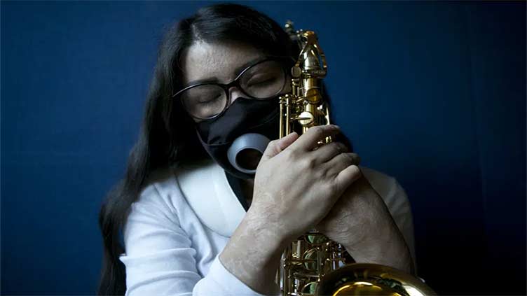 Mexican musician finds refuge in saxophone after acid attack