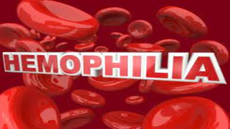 Successful gene therapy experiment for 'hemophilia' treatment