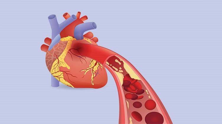 Males with obesity may be more at risk of heart complications, but why?