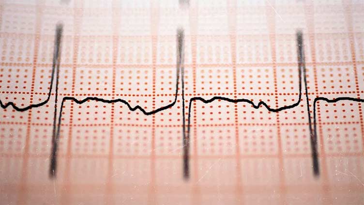 can-afib-cause-heart-failure-health-dunya-news