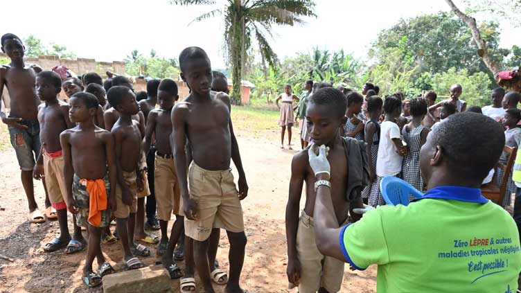  Ivory Coast leprosy sufferers fight social exclusion