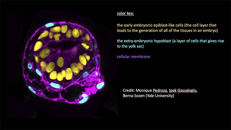 Scientists use stem cells to create models of human embryos and study our earliest days