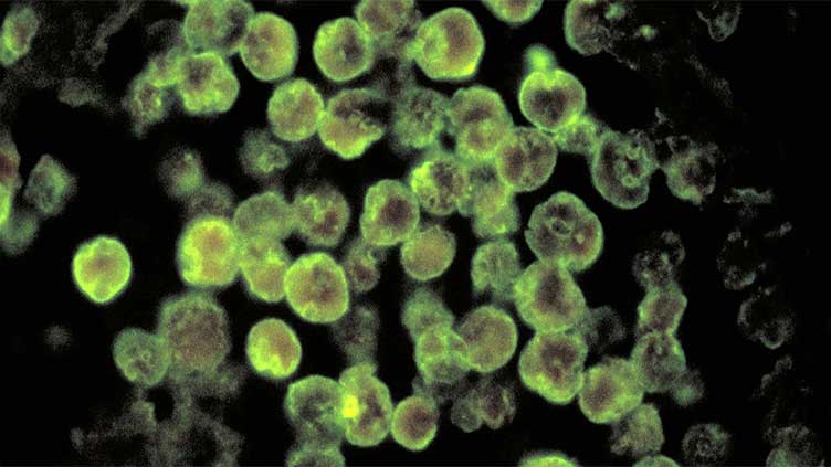 Lahore reports first case of Naegleria