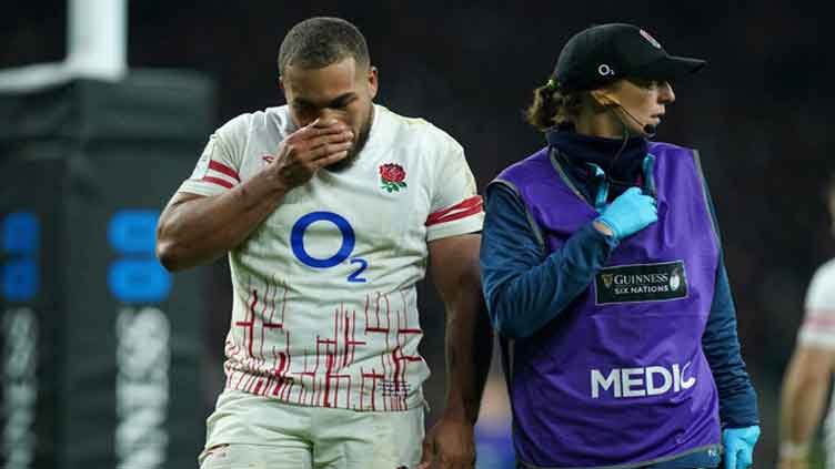 England's Lawrence out of Ireland Six Nations clash