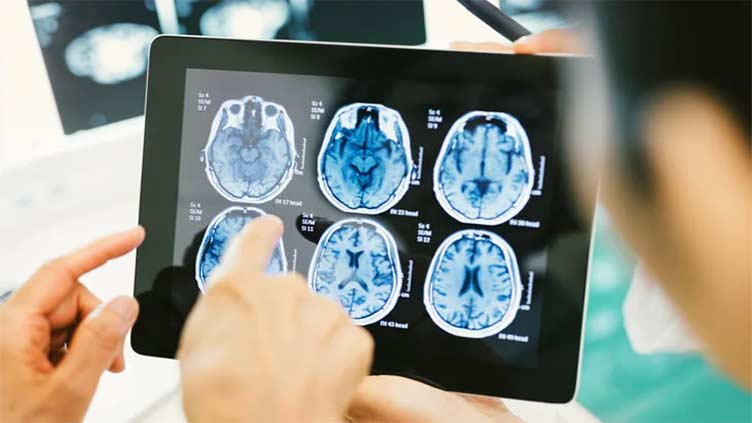 Brain Cancer Treatment: How 'Awake Surgery' and other innovations are providing hope