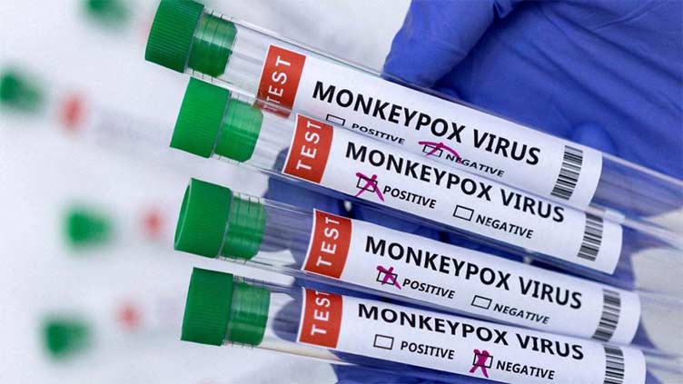 Another monkeypox case reported in Islamabad