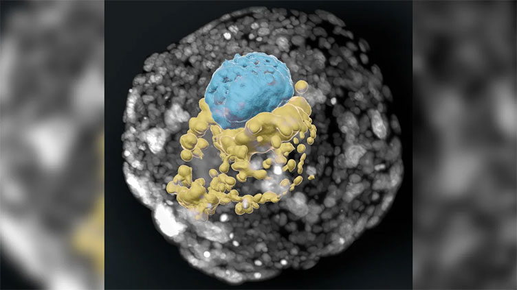 Breakthroughs in race to create lab models of human embryos raise hopes and concerns