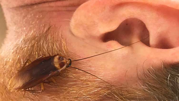 Disgusting moment woman has a live cockroach pulled out of her ear