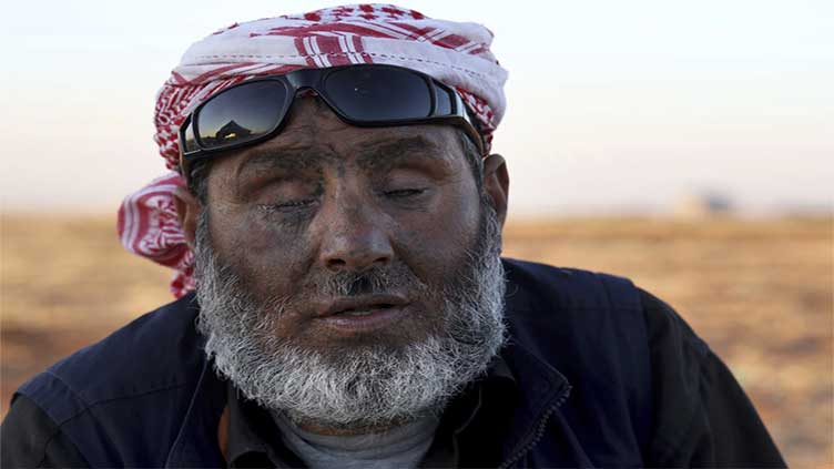 Cluster munition deaths in Ukraine pass Syria, fueling rise in weapon world tries to ban