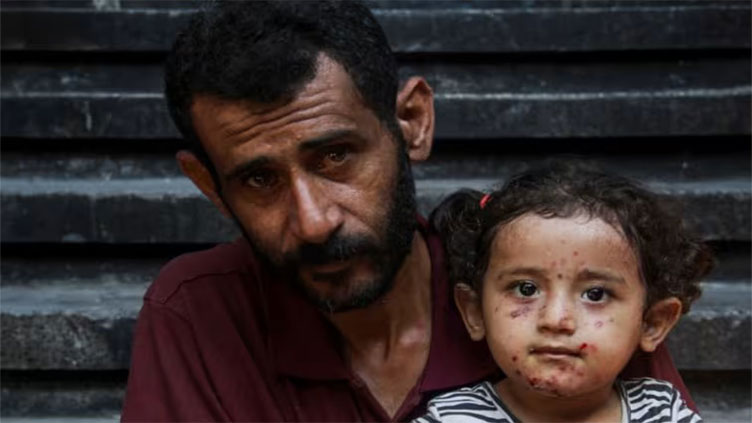 Skin diseases afflict Gaza's children as war drags on without end