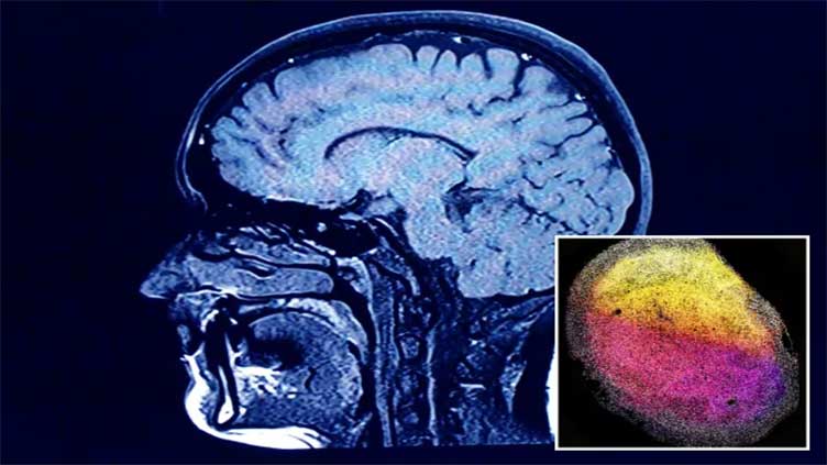 'Exciting possibilities await after scientists grow minibrains in lab