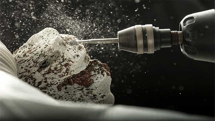 Ancient human DNA hints at why multiple sclerosis affects so many northern Europeans today