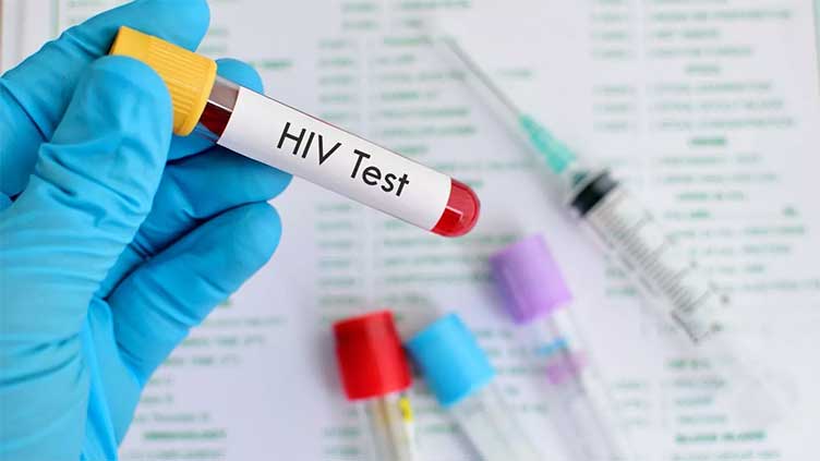 Miracle 7th person cured of HIV in 40-year history of AIDS