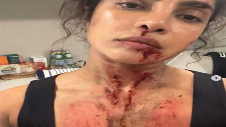 Fans freak out to see Priyanka's fake injury in film 'The Bluff'