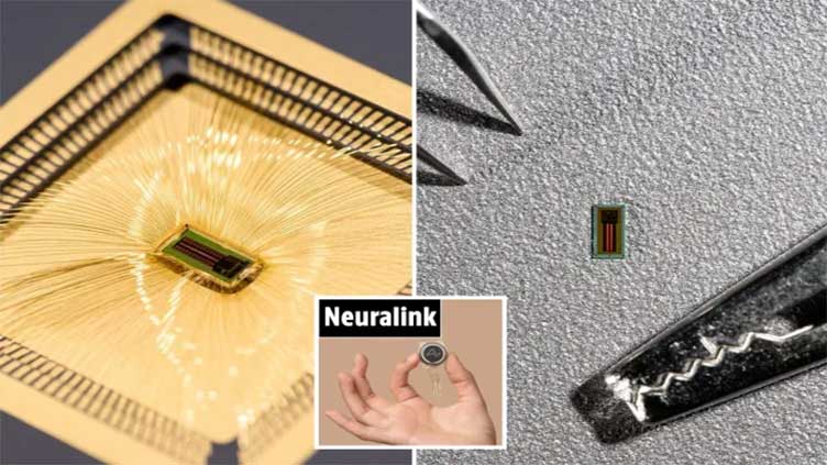 Plans for tinier brain chip to be implanted into human heads unveiled