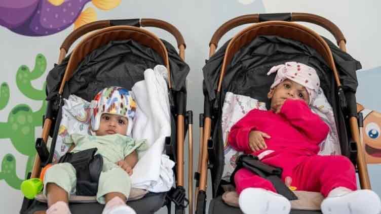 Pakistani conjoined twins successfully separated in Turkiye