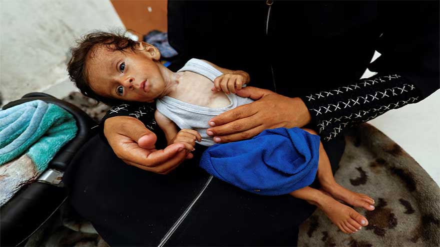 Dunya News Gaza father grieving loss of child to malnutrition scrambles to save siblings