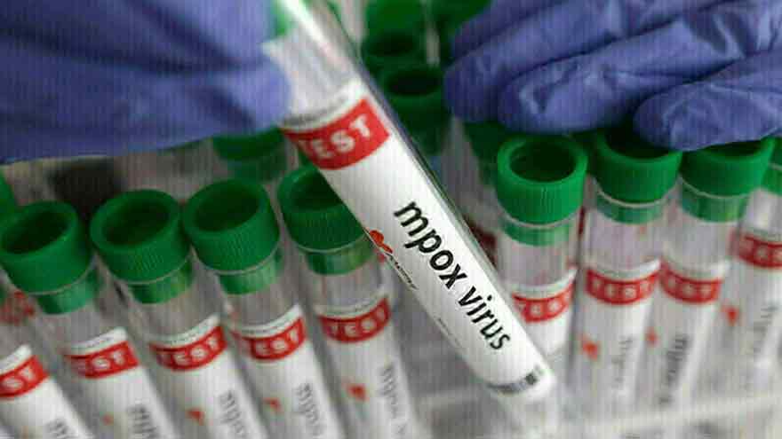 Pakistan reports new monkeypox case