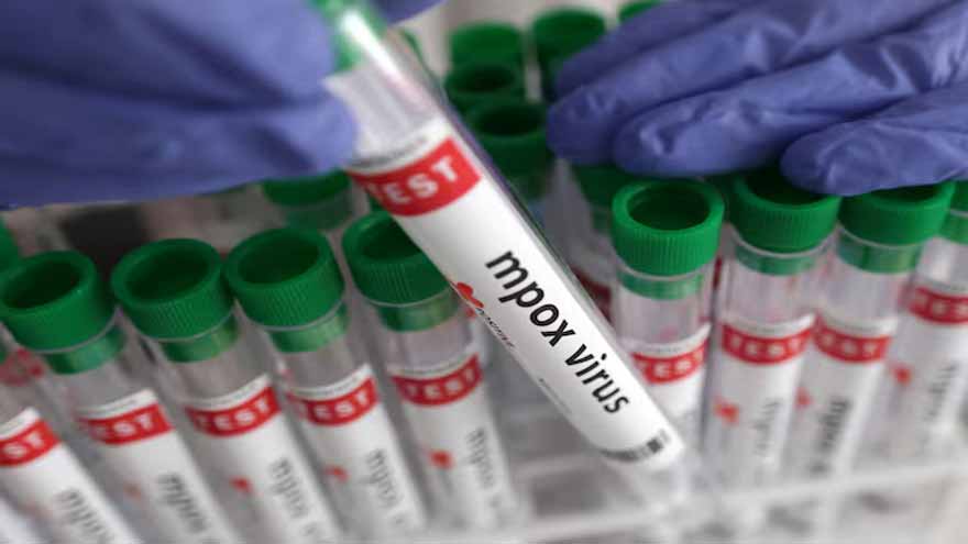 Senegal reports mpox case, patient in isolation