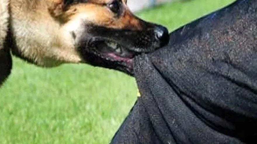 Karachi reports 29,000 dog bite cases, 19 rabies deaths in 2025 amid growing stray dog crisis