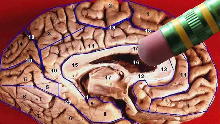 Scientists find way how to erase unwanted memories