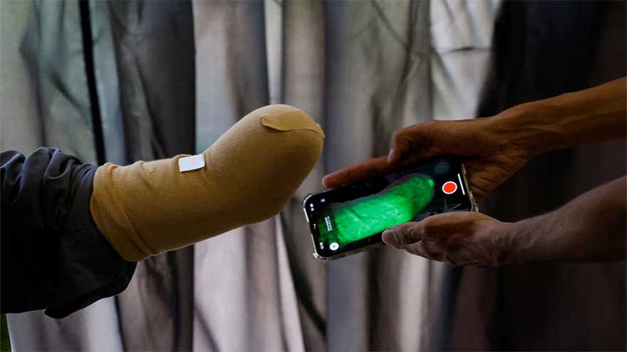 From Karachi to Gaza: Pakistani startup ships prosthetics to child war survivors