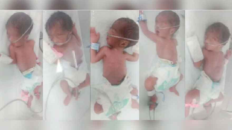 Woman gives birth to quintuplets in Karachi
