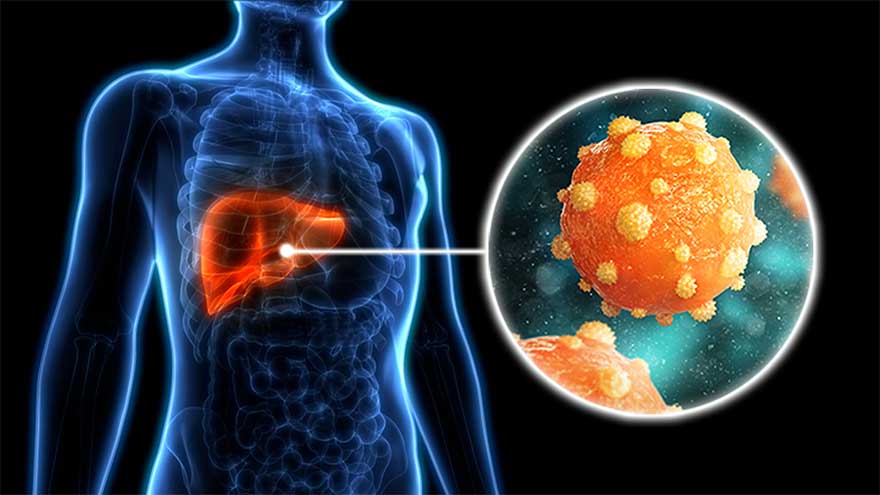 World Hepatitis Day today: theme, significance, prevention tips