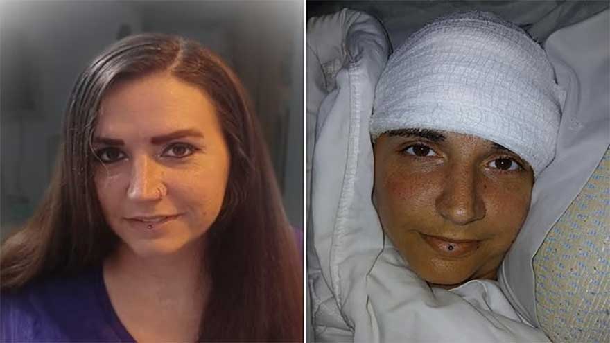 Paralysed woman reveals shocking effect of brain chip