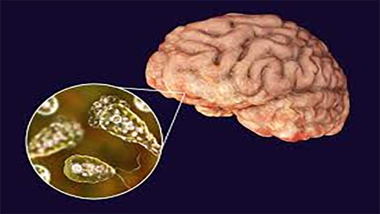 Karachi reports second death of 2025 from deadly brain-eating amoeba