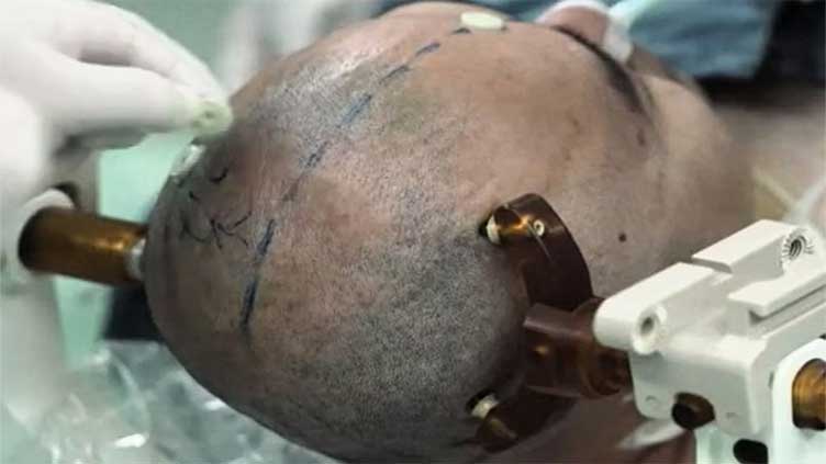 China tests brain chip to control AI agents