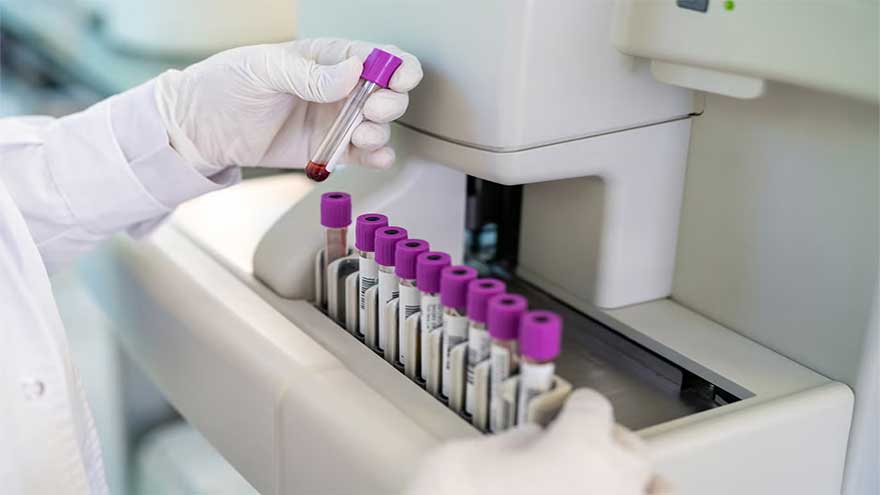 Researchers find new way to detect early signs of pancreatic cancer