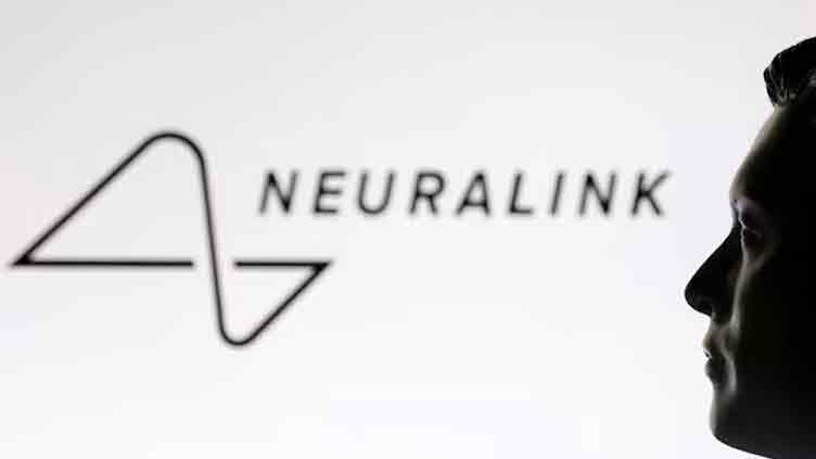 Neuralink's speech restoration device gets FDA's 'breakthrough' tag