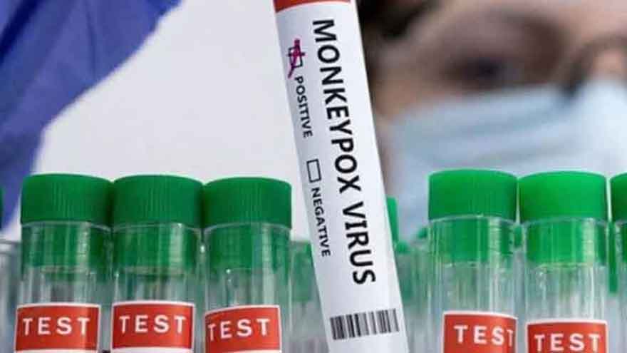 Lahore reports second monkeypox case