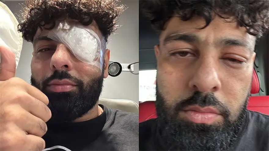 Rapper Badshah's eye injury leaves fans shocked