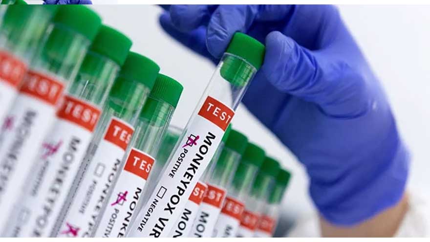 Pakistan reports second Mpox-linked death as concerns over local spread grow