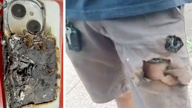 برازیل میں جیب میں رکھے موبائل فون پھٹنے سے شہری بچ گیا