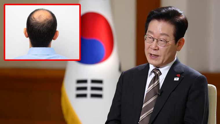 جنوبی کوریا کے صدر نے گنج پن کو ’بقا کا معاملہ‘ قرار دے دیا