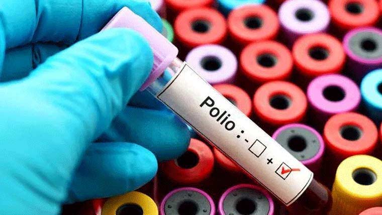 ملک بھر کے 40 ماحولیاتی نمونوں میں پولیو وائرس کی تصدیق