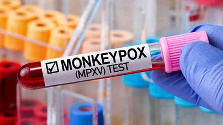 Monkeypox threat grows in Punjab as four new cases reported in Lahore