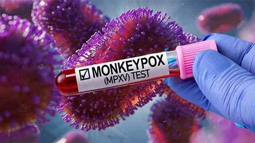 First monkeypox case reported in Multan