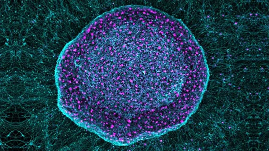 'Pain sponge' could soak up pain signals before they reach brain