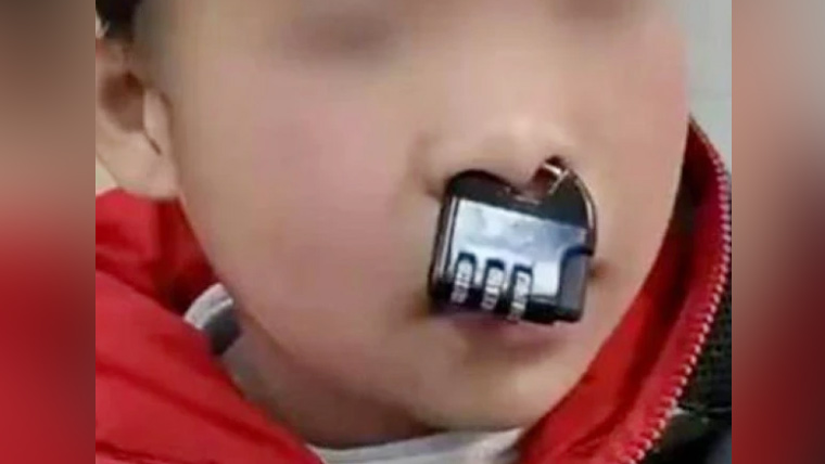 شرارتی بچے نے اپنی ناک میں تالا پھنسا لیا، ویڈیو وائرل