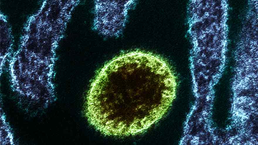 No immediate Nipah virus threat in Sri Lanka: Health official